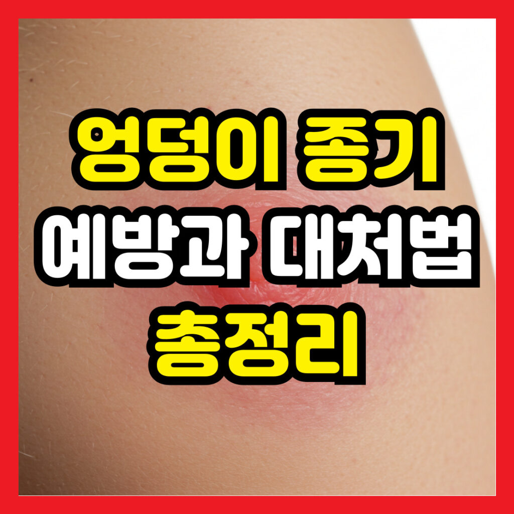 엉덩이-종기-예방과-대처법