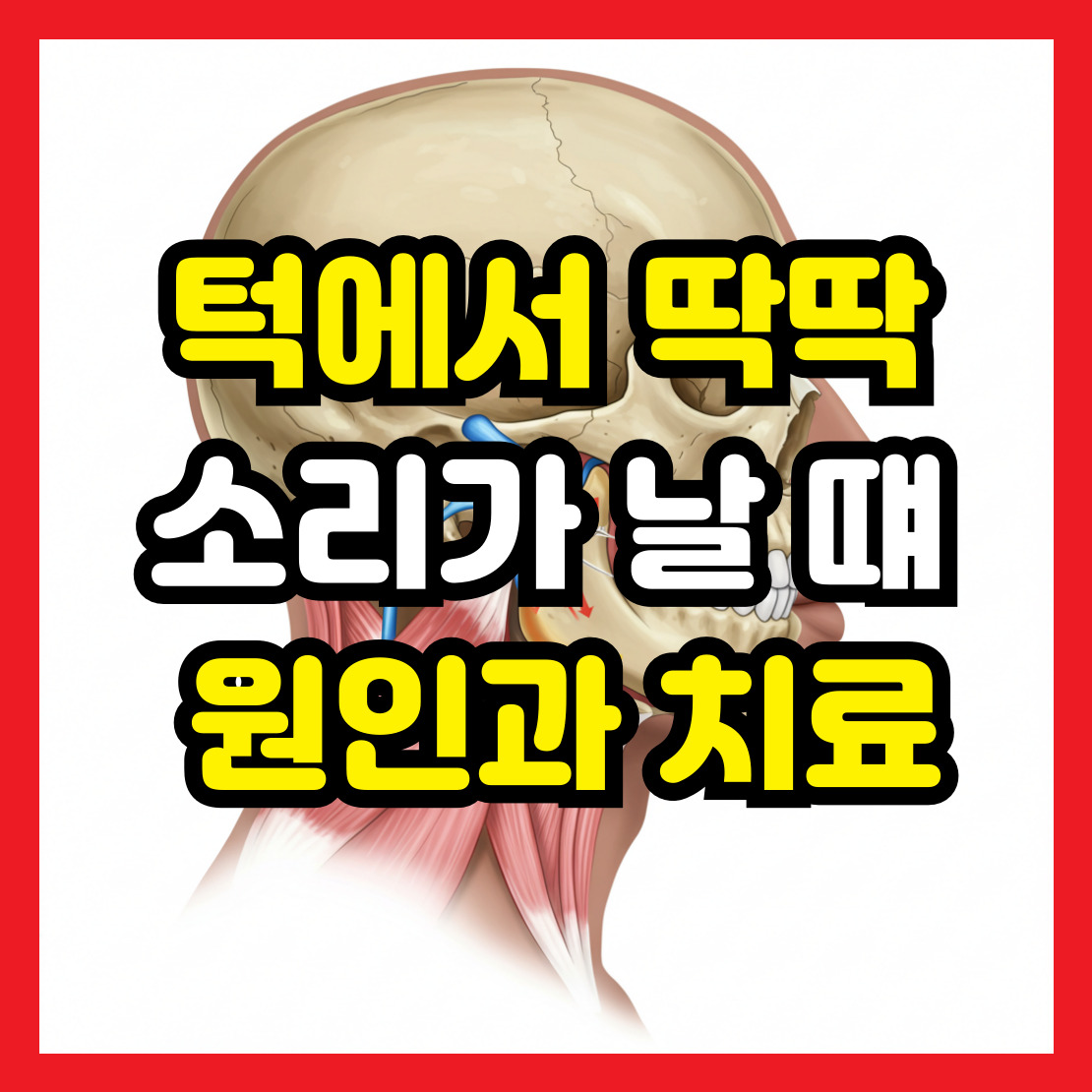 턱관절-소리